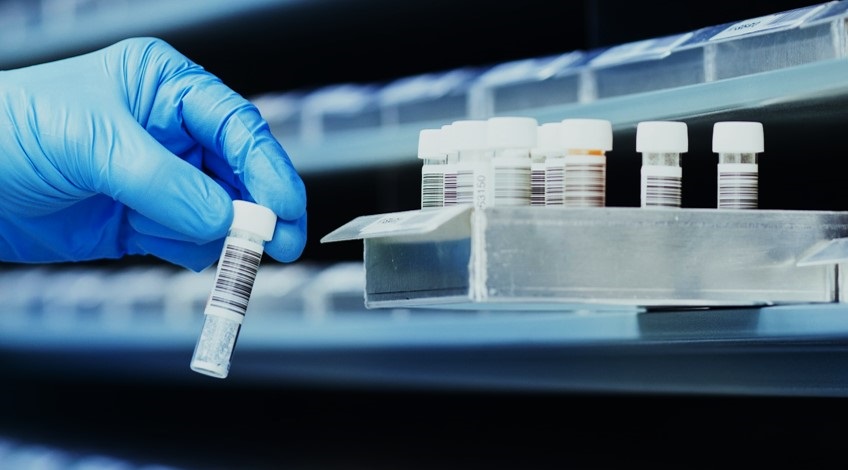 Biobanking of Human Biospecimens by Pierre Hainaut Biobanking of Human Biospecimens by Pierre Hainaut